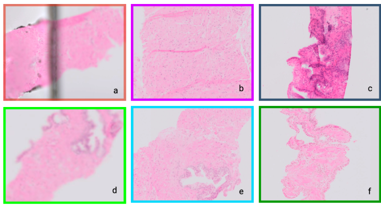 Examples of digital pathology image artefacts