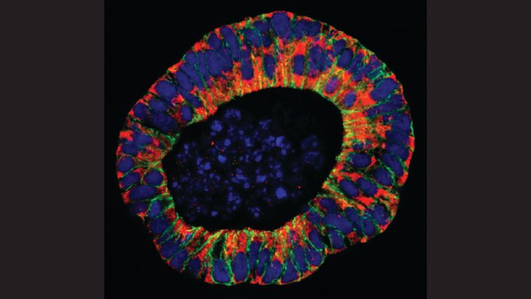 Fluorescence microscopy image of a gall bladder organoid