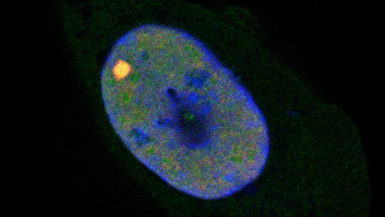 Microscopy image of the nucleus of a cell, with blue, green and red immunofluorescence colours overlaid on each other, representing the localisation of DNA and two proteins of interest (TBX2 and PCGF1).